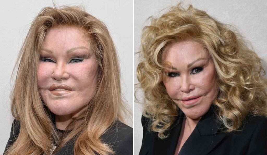 Jocelyn Wildenstein