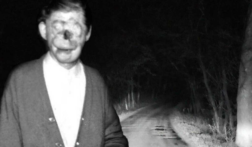 Charlie No-face legend