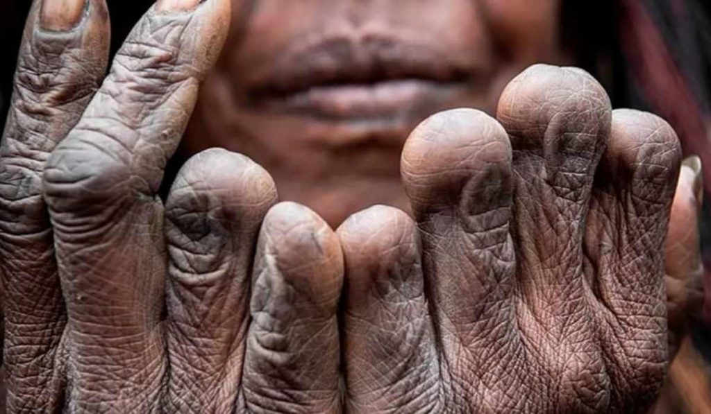 strange custom of finger cutting in Indonesia