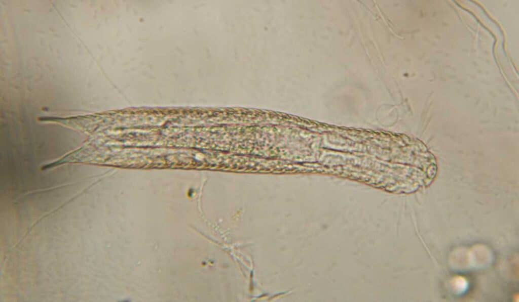 Gastrotrichs has the shortest lifespan